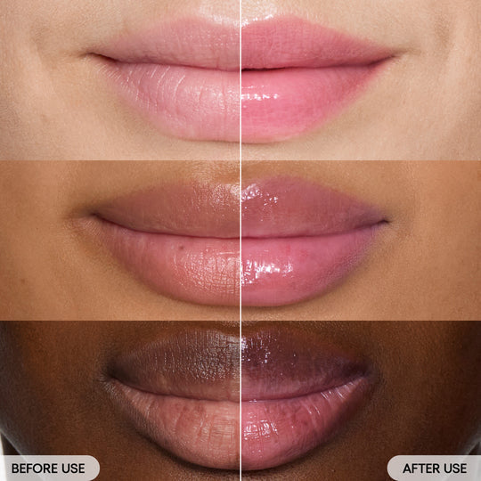 Gloss That Heals – Donut-Inspired Lip Therapy from Korea (Minimum 2)