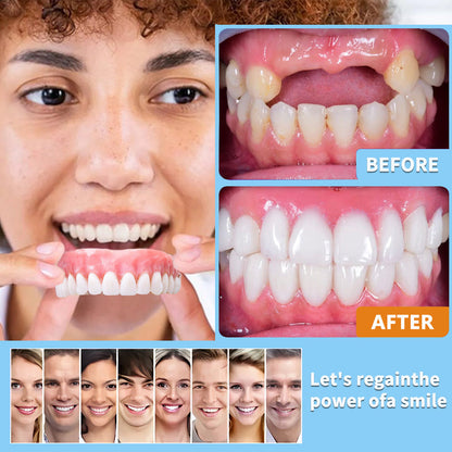 Custom-Fit Functional Dentures (Recommended by the American Dental Association (ADA))